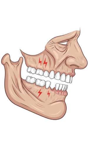 Changes in facial shape