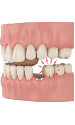 Denture discomfort or slipping