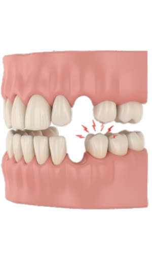 Missing or loose teeth