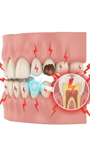 Persistent Tooth Pain