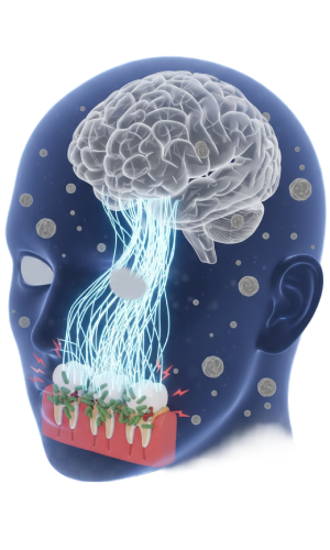 Severe Dental Anxiety