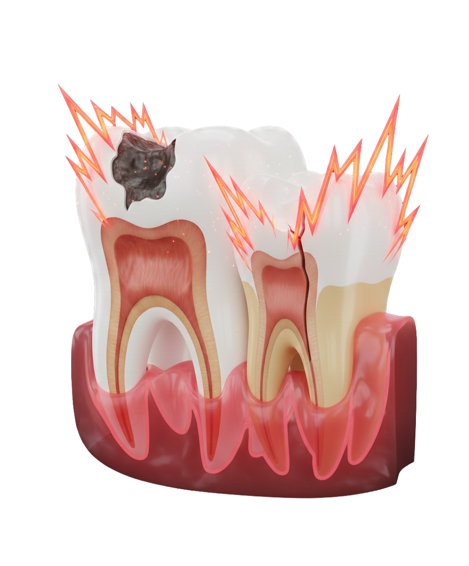 Tooth Pain