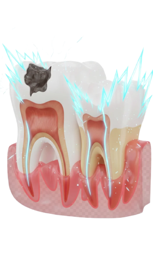 Tooth Sensitivity